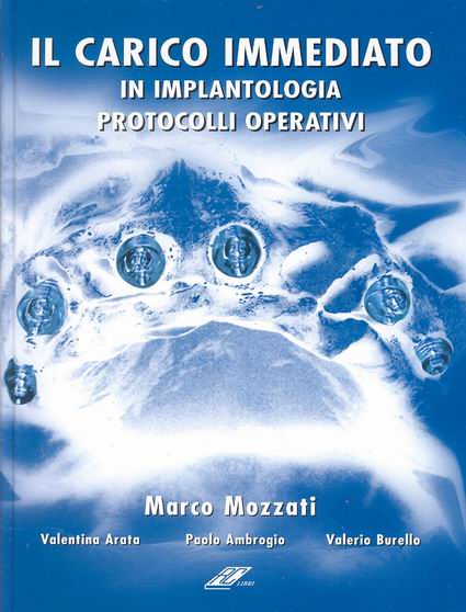 IL CARICO IMMEDIATO IN IMPLANTOLOGIA. PROTOCOLLI OPERATIVI. (Con DVD)